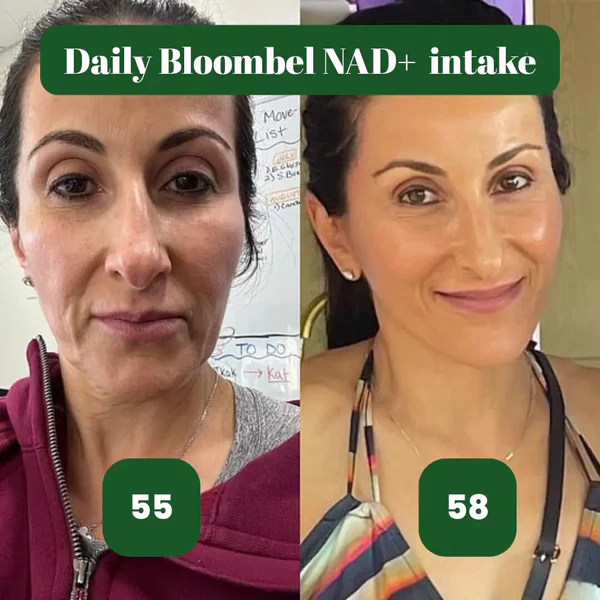 NAD+ Supplement - Skin Aging Support